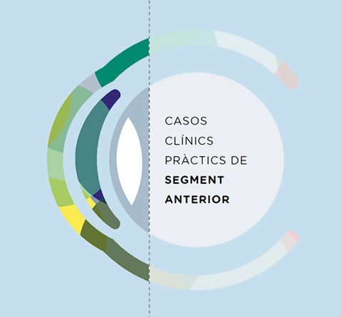 L'IMO organitza la jornada 'Casos clínics pràctics de segment anterior'